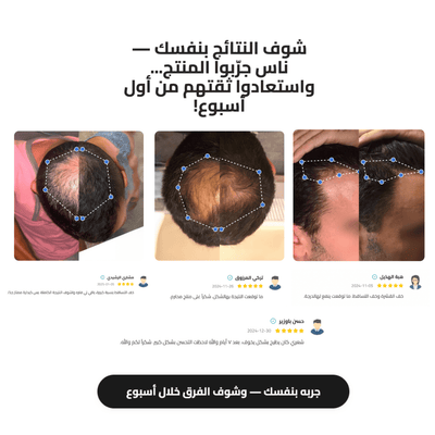 سيروم رول - أون لنمو الشعر Bodywise - Darina