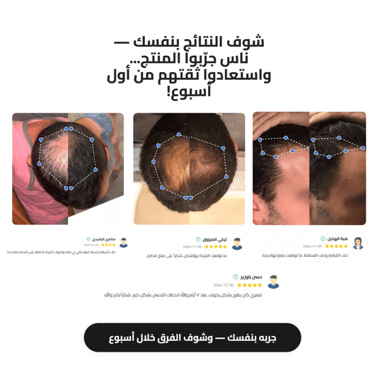 سيروم رول - أون لنمو الشعر Bodywise - Darina